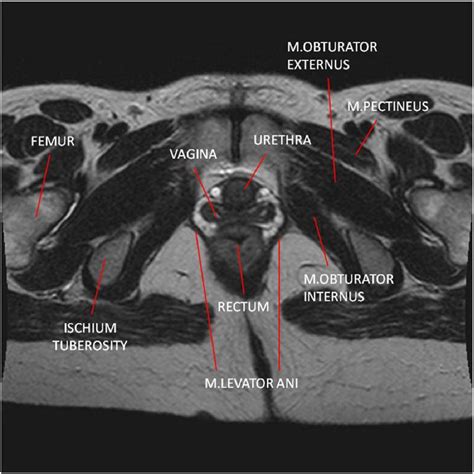 Figure From Mri And Us Anatomy Of Female And Male Pelvic Floor