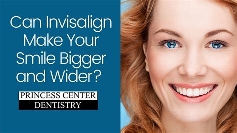 Can Invisalign Make Your Smile Wider And Bigger Youtube