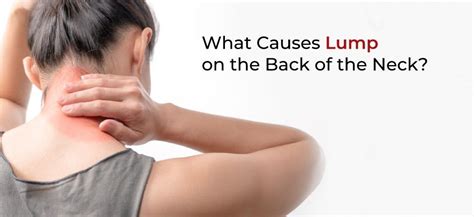 Lumps In Back Of Neck And Head