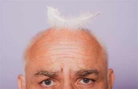 Senior Old Aged Head Of Bald Man Hair Loss Baldness With Feather