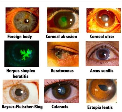 Corneal Ulceration Vs Abrasion Understanding The Differences Cats