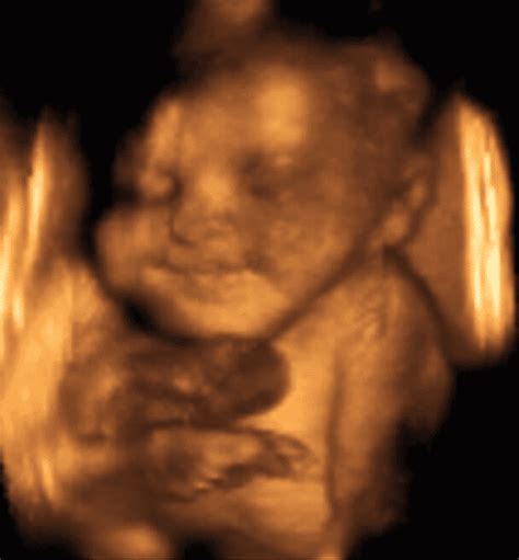 32 Weeks And 3 Days Pregnant Baby Fetal Progress Ultrasound
