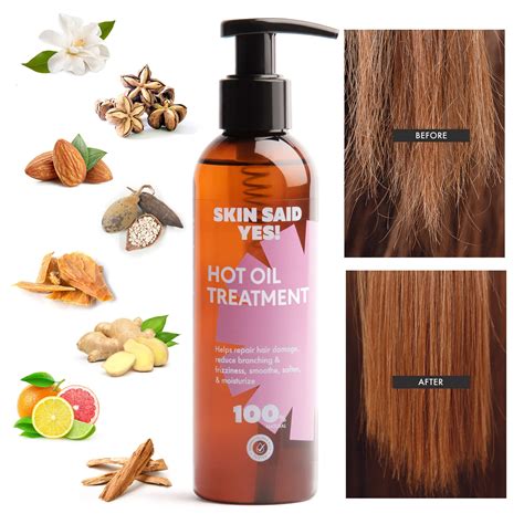 Top More Than 82 Dry And Rough Hair Treatment Best Vn