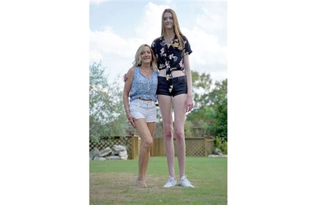 Teenager Breaks Double World Records For Longest Legs