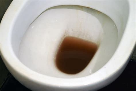 5 Main Reasons Why Is Your Toilet Water Brown Fixed