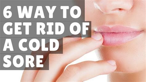 6 Way To Get Rid Of A Cold Sore Home Remedies Fast Overnight Youtube