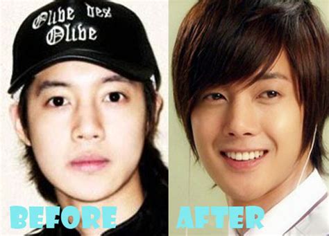 Kim Hyun Joong Plastic Surgery Before And Nose Job Lovely Surgery