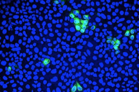 Visualising viral infection with immunofluorescence microscopy - The