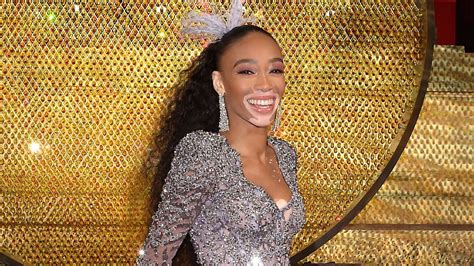 Winnie Harlow Makes History As Sports Illustrateds First
