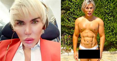 We did not find results for: You Won't Believe These Pre-Surgery Photos Shared By The ...