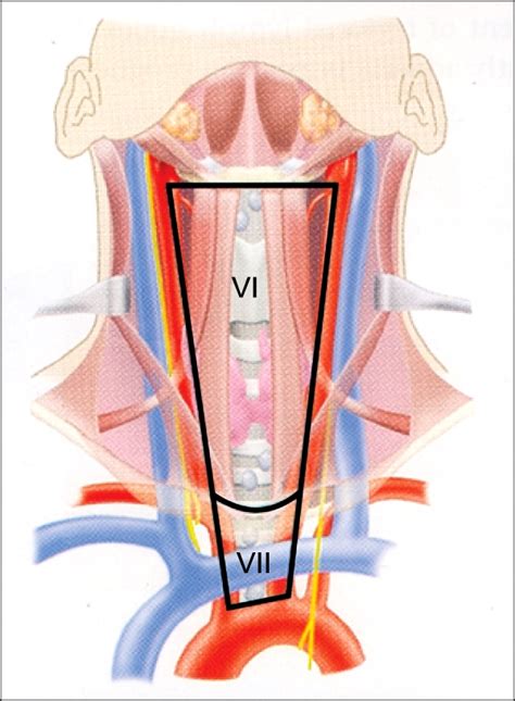 Anatomical Boundaries Of Nodal Levels Vi Central Compartment Group