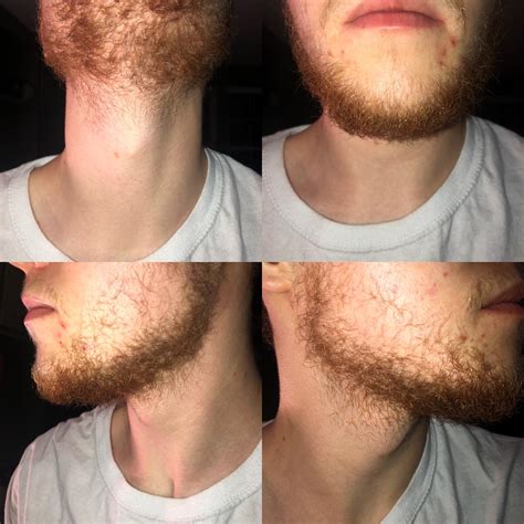 Albums 92 Pictures Stages Of Beard Growth Pictures Latest