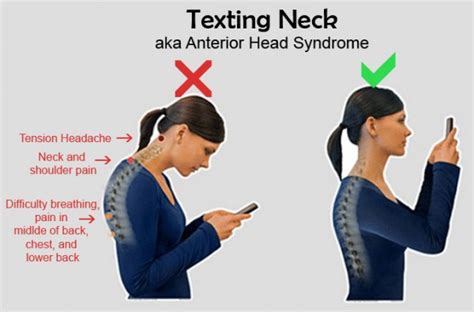 Forward Head Posture The Texting Neck And The Desktop Neck Whole