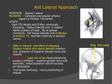 Hip Arthroplasty Surgical Anatomy And Approaches