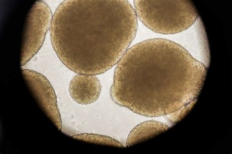 Rogue Stem Cell Clinics Come Under Microscope As California Considers