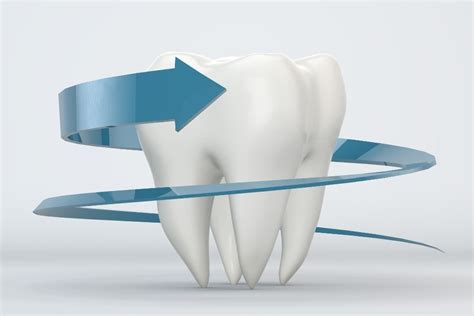 Managing A Chipped Tooth Emergency Pro Health Dental