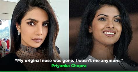 Priyanka Chopra Reveals Trolls Called Her Plastic Chopra After Her Nose Surgery Went Wrong