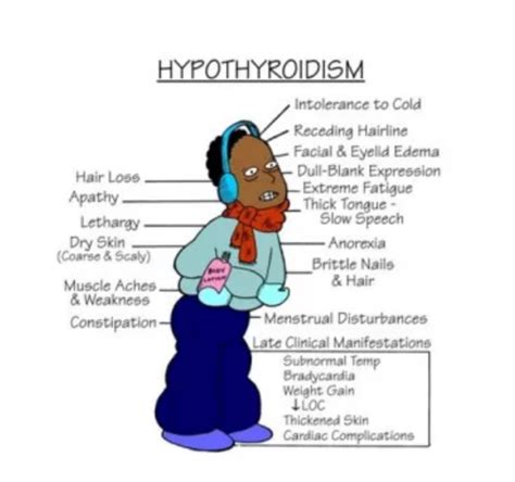 Hypothyroidism Symptoms Face Click Image For More Details Hot Sex Picture