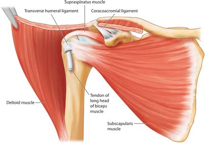Rotator cuff tendonitis refers to the acute (recent) irritation of the tendon of the rotator cuff and often the surrounding bursa. Subacromial Subdeltoid Bursa | Anesthesia Key