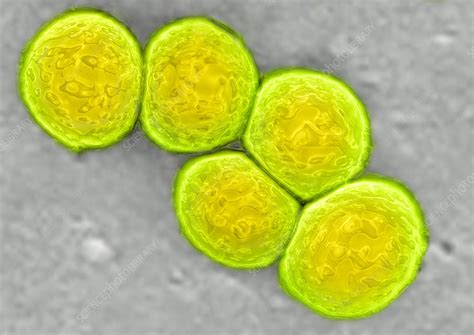 Staphylococcus Aureus Tem Stock Image C0129959 Science Photo