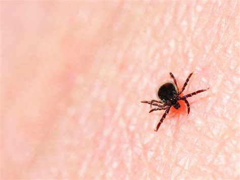 Tick Diseases In Vermont Getting Worse Study Finds