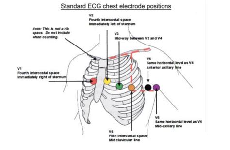 63 Technique For Locating Chest Electrode Positions