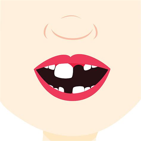Missing Tooth Illustrations Royalty Free Vector Graphics And Clip Art