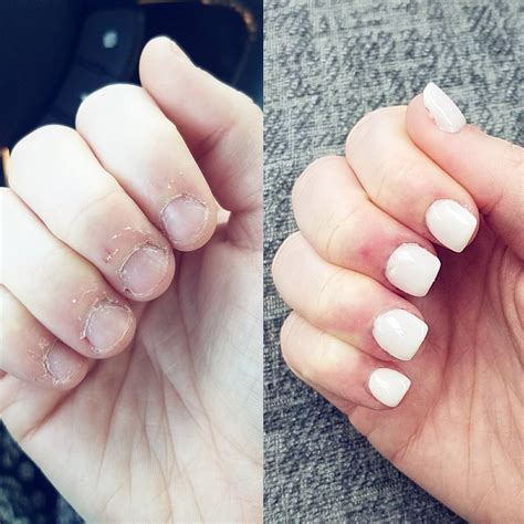 Review Of How To Apply Gel Nails On Short Bitten Nails 2022 Fsabd42