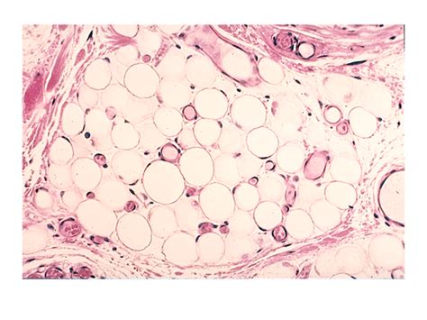It provides structural support and. MIT, Brigham team designs fat-fighting nanoparticles that ...