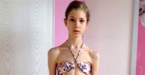 Girl Battling Anorexia Who Weighed Just Three And A Half Stone Says Love Saved Her Life Mirror
