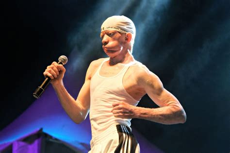 20 Surprising Facts About Yellowman