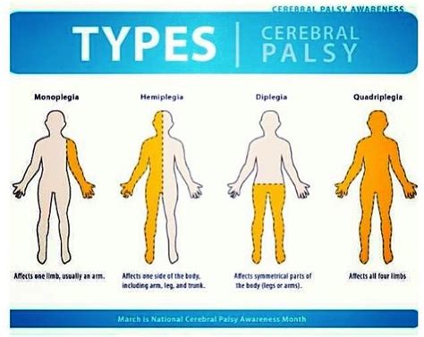 Cerebral Palsy Classifications Of Cerebral Palsy