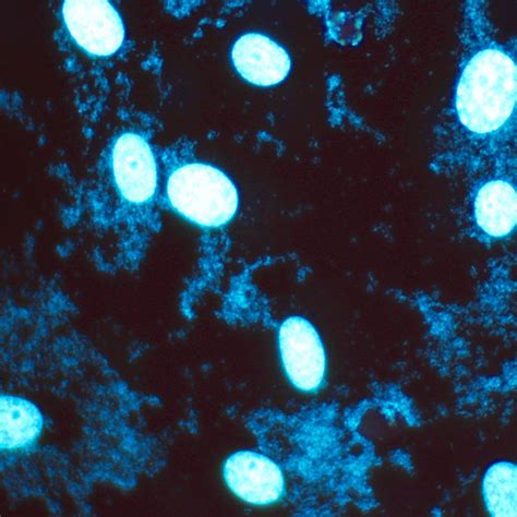 Mycoplasma Contamination In Cell Culture