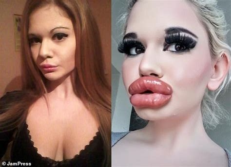 Real Life Barbie Andrea Ivanova With The Biggest Lips In The World Shows Off Huge New Pout