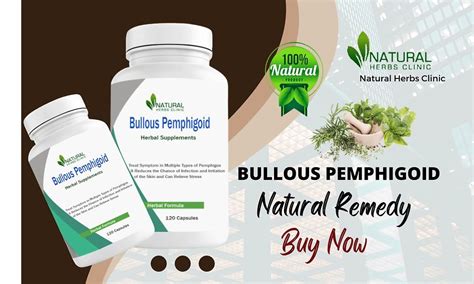 Natural Herbs Clinic You Wont Believe This Bullous Pemphigoid