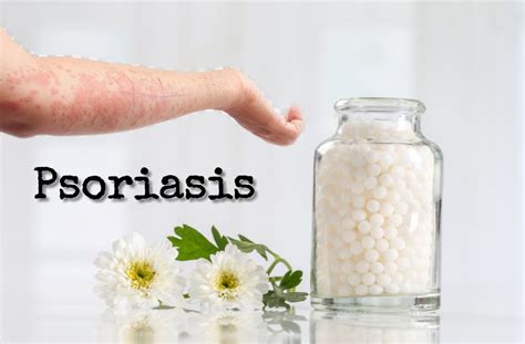 Inerythrodermic Palmoplantar Pustular Psoriasis Types Pictures