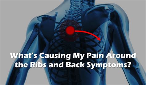What Causes Pain Around The Ribs And Back Symptoms How Can This Be Treated Regenexx