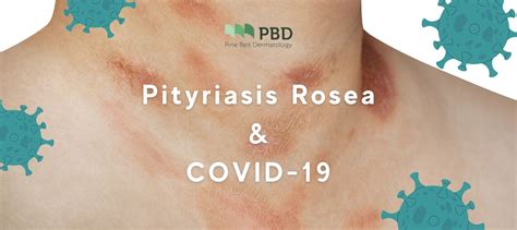 Pityriasis Rosea And Its Connection To Covid 19pine Belt Derm Ms