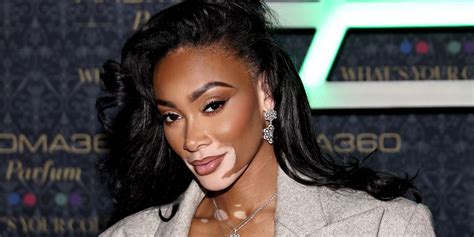 Winnie Harlow Shares The Self Care Practice That Keeps Her Grounded