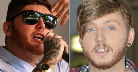 celebrity teeth before and after james arthur debuts a brand new image minus his braces we