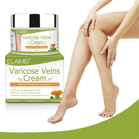 Varicose Veins Treatment Cream 50g Spider Vein Cream Relief Tired And