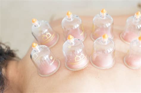Centuries Old Cupping Therapy Brings Relief According To Wall Street
