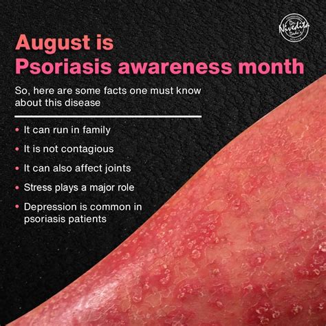 Facts About Psoriasis August Is Observed As Psoriasisawarenessmonth