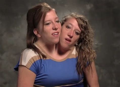 Conjoined Twins Abby And Brittany Hensel Star In New Tlc Show Abby
