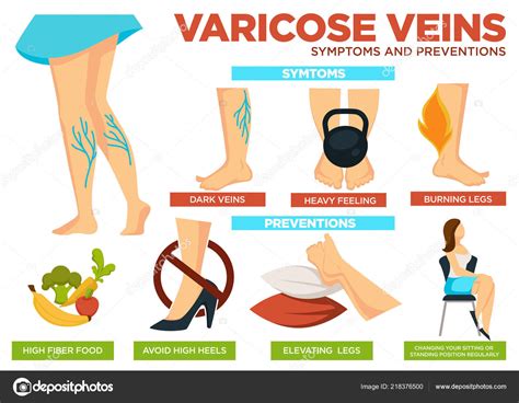 Varicose Veins Symptoms Preventions Poster Info Vector Heavy Feeling