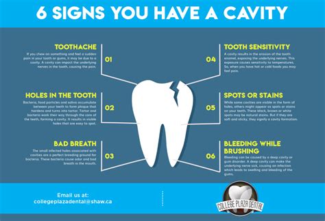 6 Signs You Have A Cavity College Plaza Dental Associates