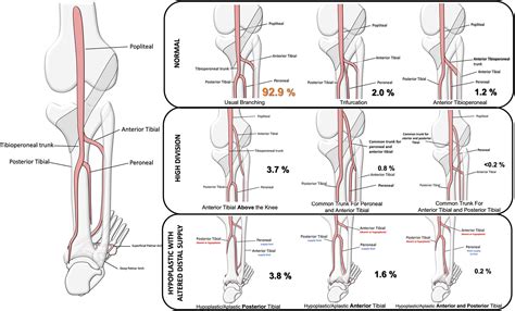 Arteries Of The Lower Limb—embryology Variations And Clinical