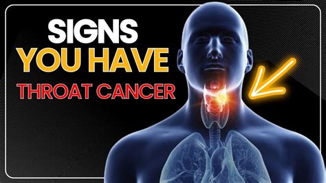 10 Signs You Have Throat Cancer Youtube