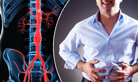Stomach Pain Could Be A Symptom Of Aortic Abdominal Aneurysm Express