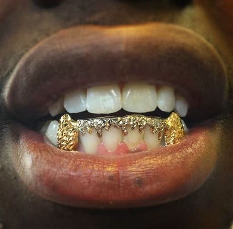 Pin By Storm And Grace On Pucker Up Grillz Teeth Grillz Diamond